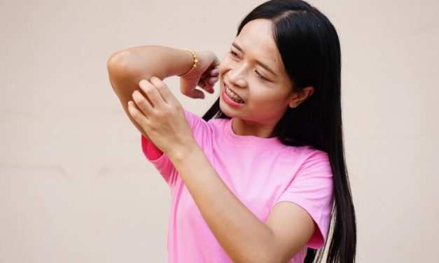 Alergi Kacang, Kenali Penyebab, Gejala Dan Cara Mengelolanya