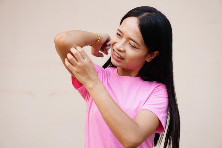 Alergi Kacang, Kenali Penyebab, Gejala Dan Cara Mengelolanya