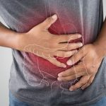 Duodenitis, Peradangan pada Usus Dua Belas Perlu Di Waspadai