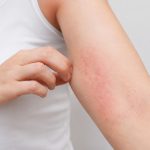 Menjaga Kesehatan Kulit Di Musim Pancaroba