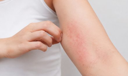 Menjaga Kesehatan Kulit Di Musim Pancaroba