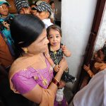 Achondroplasia Kelainan Pertumbuhan Tulang, Ini Ciri-cirinya!