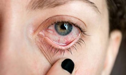 Penyakit Uveitis Peradangan Yang Terjadi Pada Uvea
